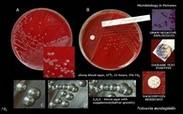 neisseria meningitidis